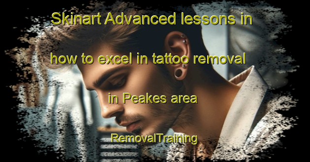 Skinart Advanced lessons in how to excel in tattoo removal in Peakes area | RemovalTraining | RemovalClasses | SkinartTraining-Canada