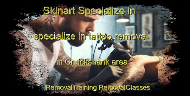 Skinart Specialize in specialize in tattoo removal in Cruickshank area | #RemovalTraining #RemovalClasses #SkinartTraining-Canada